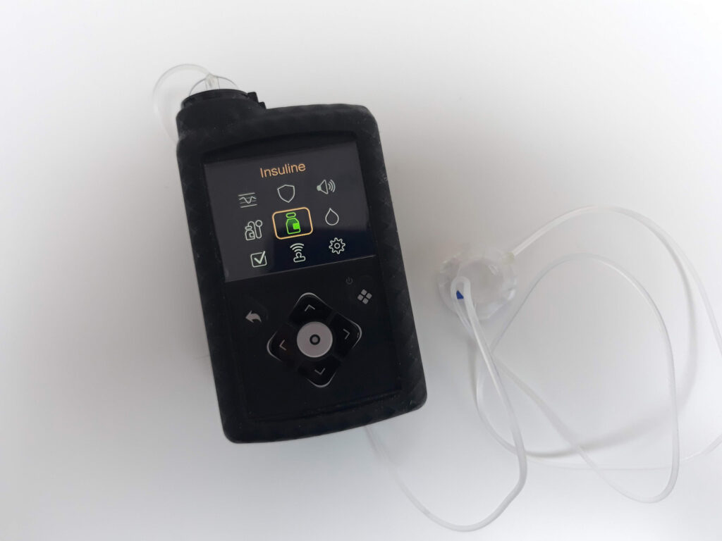 Medtronic780g insulinepomp foto van mijn insulinepomp