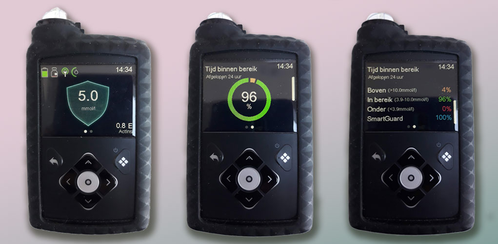 Diabetes | smartguard insulinepomp afbeelding van drie verschillende schermen van mijn insulinepomp